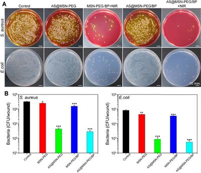 Photothermal 2D Nanosheets Combined With Astragaloside IV for Antibacterial Properties and Promoting Angiogenesis to Treat <mark class="highlighted">Infected Wounds</mark>